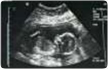 Obstetric Ultrasound