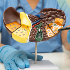 Fatty Liver Disease: Causes, Symptoms & Prevention